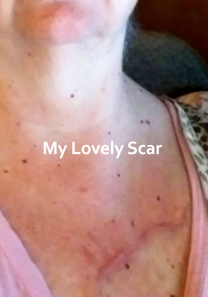 lovely-scar-lg